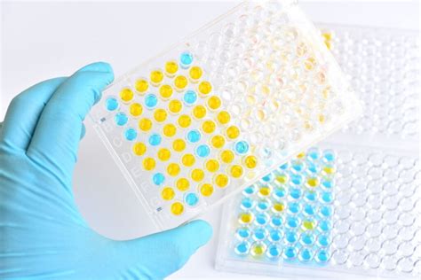 Test krwi ELISA: do czego służy i jak się go wykonuje